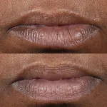 CP+ Терапия для губ 0,15 унции FG Perricone Md - фото 3