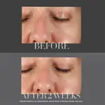 KateCeuticals Resurfacing Night Peel 30мл Kate Somerville - фото 4