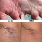 Крем для лечения экземы Hypothesis, Full size - фото 2