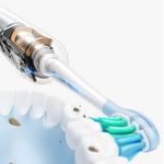 Электрическая зубная щетка Usmile - фото 7