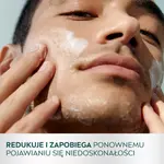Пилинг против несовершенств, 150 мл Nivea Derma skin clear - фото 2