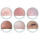 Роллер для дермы Scs3In1 Dexxer - фото 4