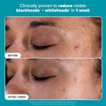 Тоник-пилинг Skin Perfecting с 2% BHA для чистой кожи Paula's Choice, 1 oz/30 mL - фото 5