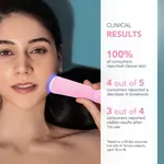 Устройство ESPADA 2 - жемчужно-розовый Foreo - фото 4