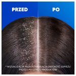 Шампунь против перхоти, 400 мл Head&Shoulders Sensitive - фото 2