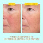 Сыворотка с мягким витамином С C-Luma Hydrabright Drunk Elephant - фото 4