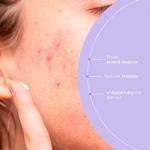 Уход за лицом с азелаиновым сиянием 50 мл Freshly Cosmetics - фото 5