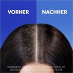 Шампунь против перхоти Apple Fresh head & shoulders, 300 ml - фото 6