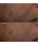 Крем для лица CLINIQUE Even Better Clinical Brightening Moisturizer, 50 ml - фото 5