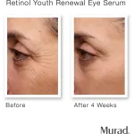 Сыворотка для глаз с ретинолом для омоложения Murad - фото 4