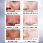 Очищающее средство Unisex AOFUXUE - фото 4