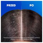 Шампунь против перхоти Head&Shoulders Apple Fresh 300 мл - фото 5