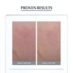 Успокаивающий уход против покраснений 50 мл Eucerin - фото 4