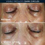 Многофункциональный крем для глаз Multi-Corexion 5-в-1 RoC - фото 4