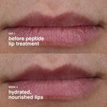 Питательный блеск для губ с пептидами rhode, 0.3oz/10ml - фото 7