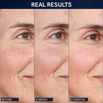 Ночная сыворотка Future Renew Damage Reversage No7 - фото 5