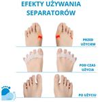 Мультигелевые сепараторы для пальцев ног от синих шишек (2 шт.) Н16Н Neuron - фото 4