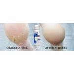 Формула для потрескавшихся пяток 125 мл Footlogix - фото 2