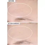 Super-C spf 30 витамин c увлажняющий крем для лица Strivectin - фото 3