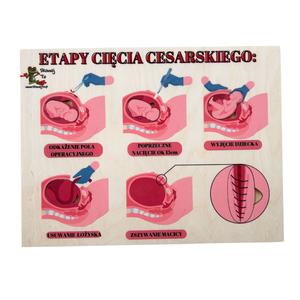 Этапы кесарева сечения деревянный пазл, роды, беременность Inna marka