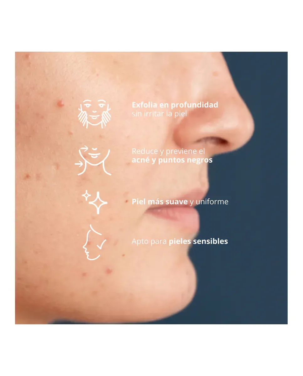Сыворотка Freshly Cosmetics — Эксполяционный Blue Radiance Enzymatic Serum, 30 мл — фото 4