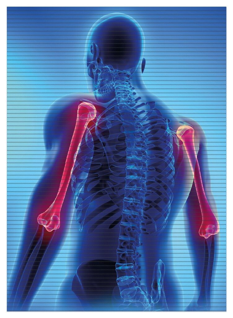 

Коврик для душа Wallario, нескользящий коврик, коврик для ванной комнаты, анатомия плечевой кости человека, размер около 90 x 65 см, черный