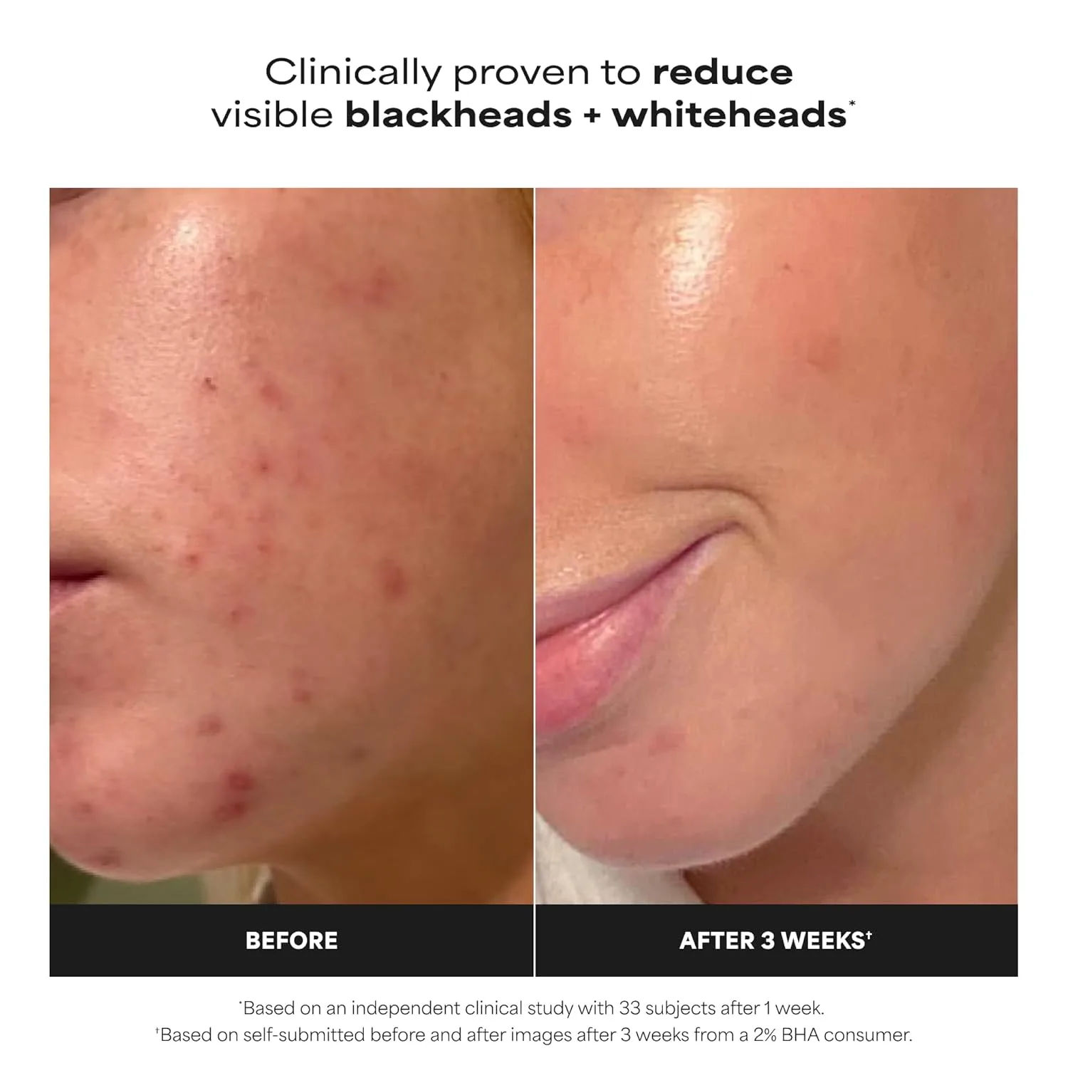 Paula's Choice SKIN PERFECTING 2% BHA жидкий эксфолиант с салициловой кислотой для пор, морщин и черных точек, без отдушки 29,6 мл — фото 2