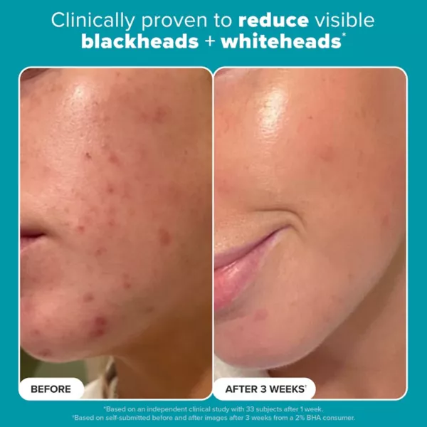 Отшелушивающий тоник Paula's Choice Skin Perfecting 2% BHA — фото 2