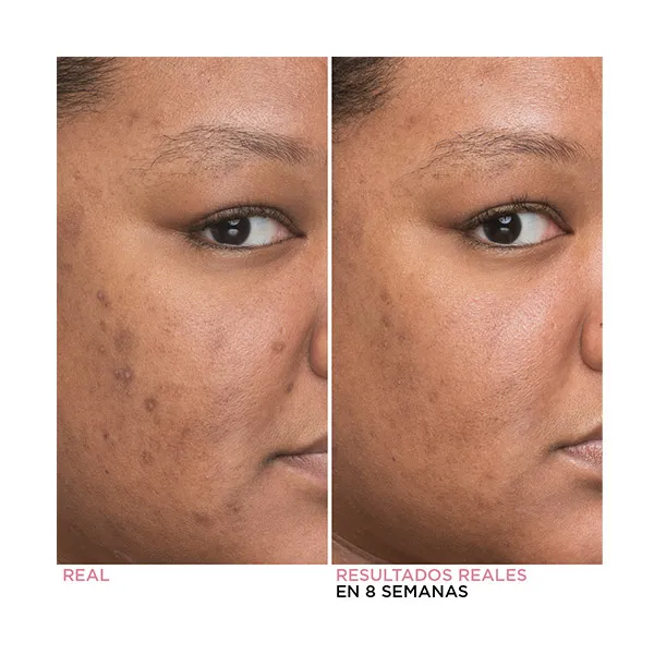 Сыворотка, минимизирующая темные пятна Bye Bye Dark Spots Niacinamide Serum It Cosmetics, 30 ml — фото 3