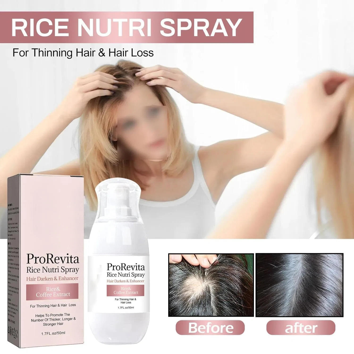 Спрей для роста волос «H-Regrow 2.0 ProRevita Rice Nutri» от Zephta Clisole, 3 Pieces. — фото 2