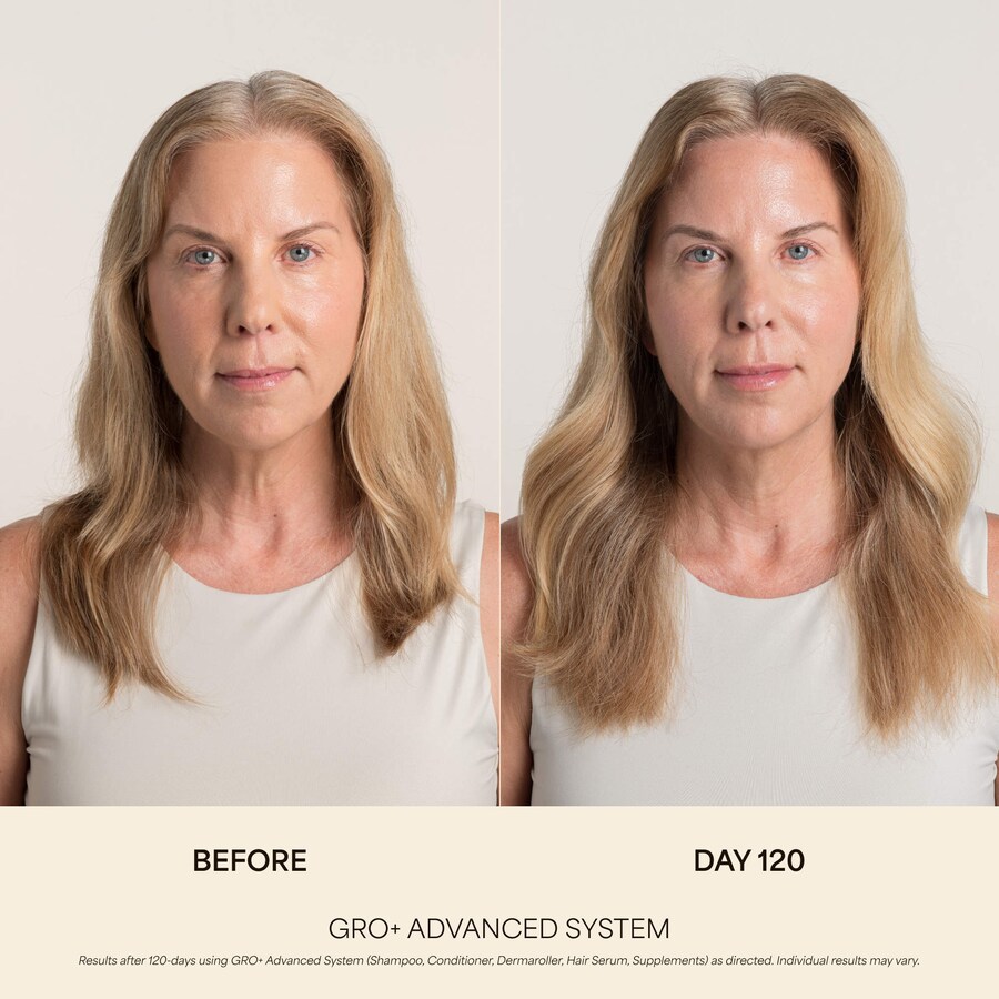 Кондиционер GRO+ Advanced Balancing Conditioner для борьбы с выраженными признаками истончения волос. Vegamour, 8 oz /236 ml — фото 2