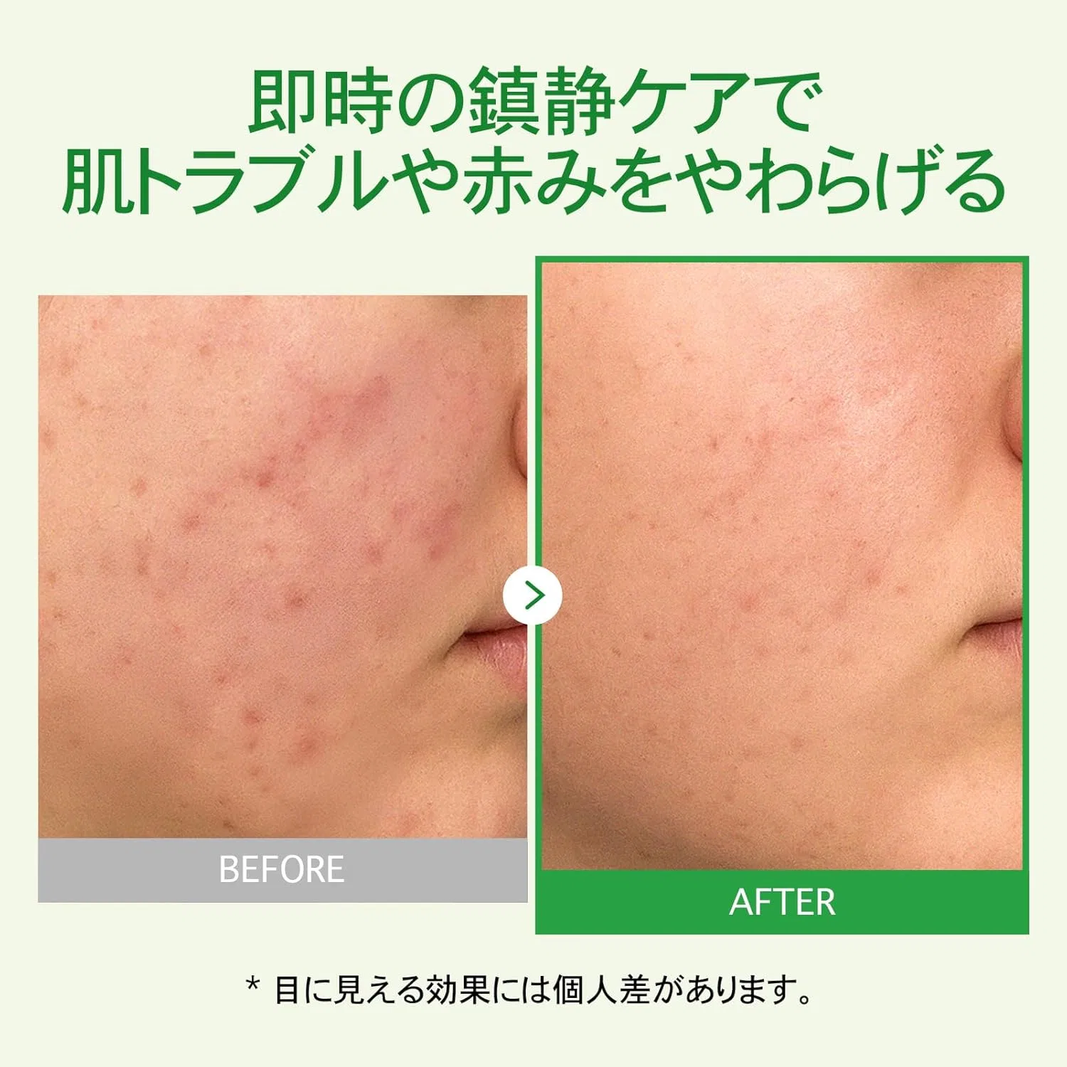 Патчи под глаза Tosowoong — Дневной Madagascar Centella Cream с центеллой, 50 мл — фото 4