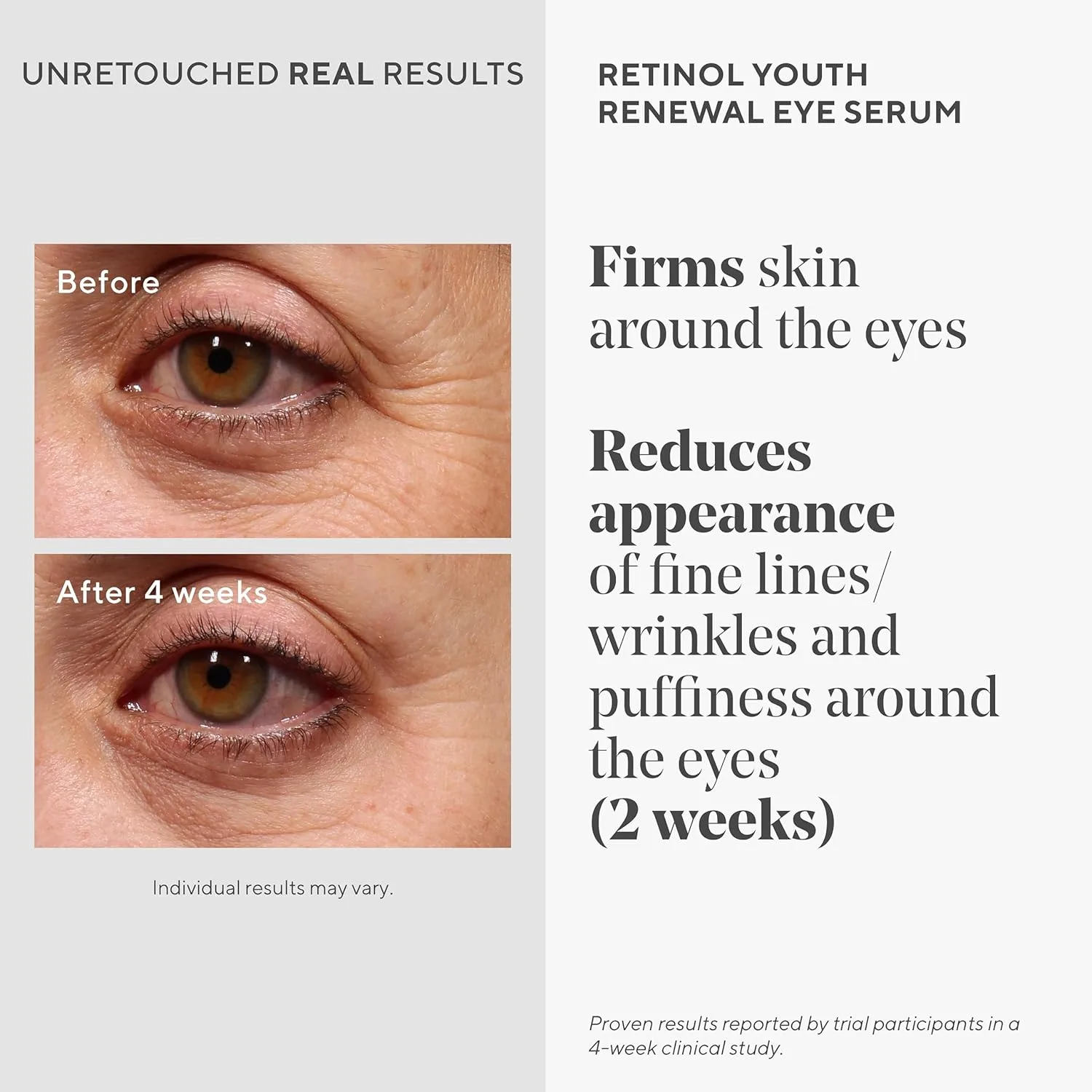 Murad Bright Eyed & Spotless Combo - набор из 2 сывороток: Retinol Youth Renewal Eye и Rapid Dark Spot Correcting для осветления кожи и уменьшения морщин — фото 3
