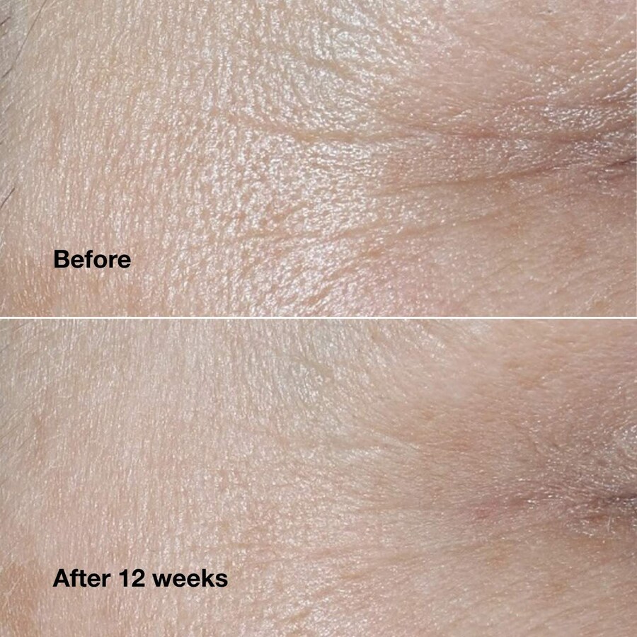 Сыворотка Clinique — Smart Clinical Repair для коррекции морщин и борьбы с признами старения, содержащий, 50 мл — фото 4