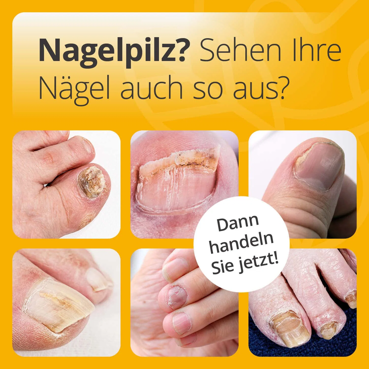 Набор для ухода за ногтями: масло для ногтей и концентрат для ванночек для ног Casida — фото 2