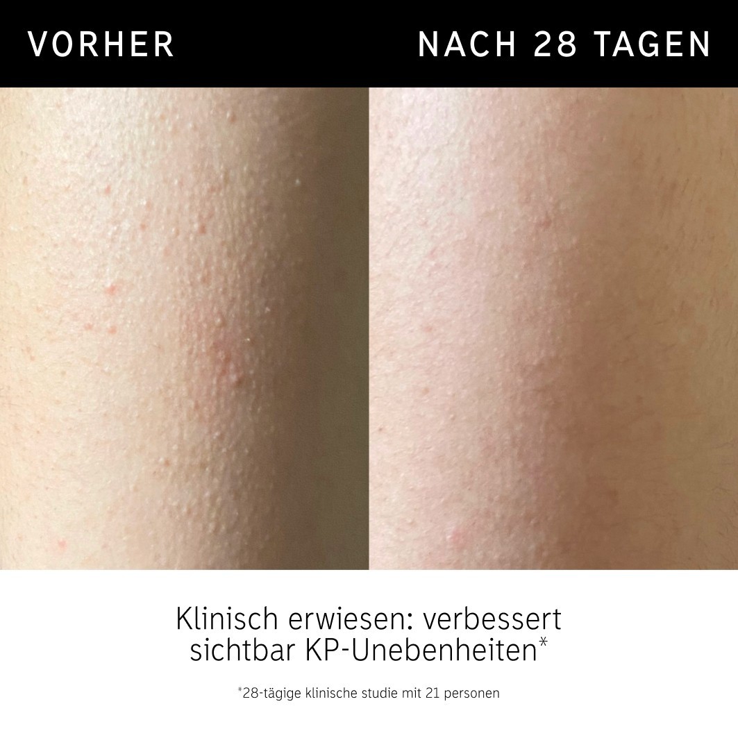 Скраб для тела peeling-stift für den körper mit glykolsäure The Inkey List, вес 45 гр. — фото 3