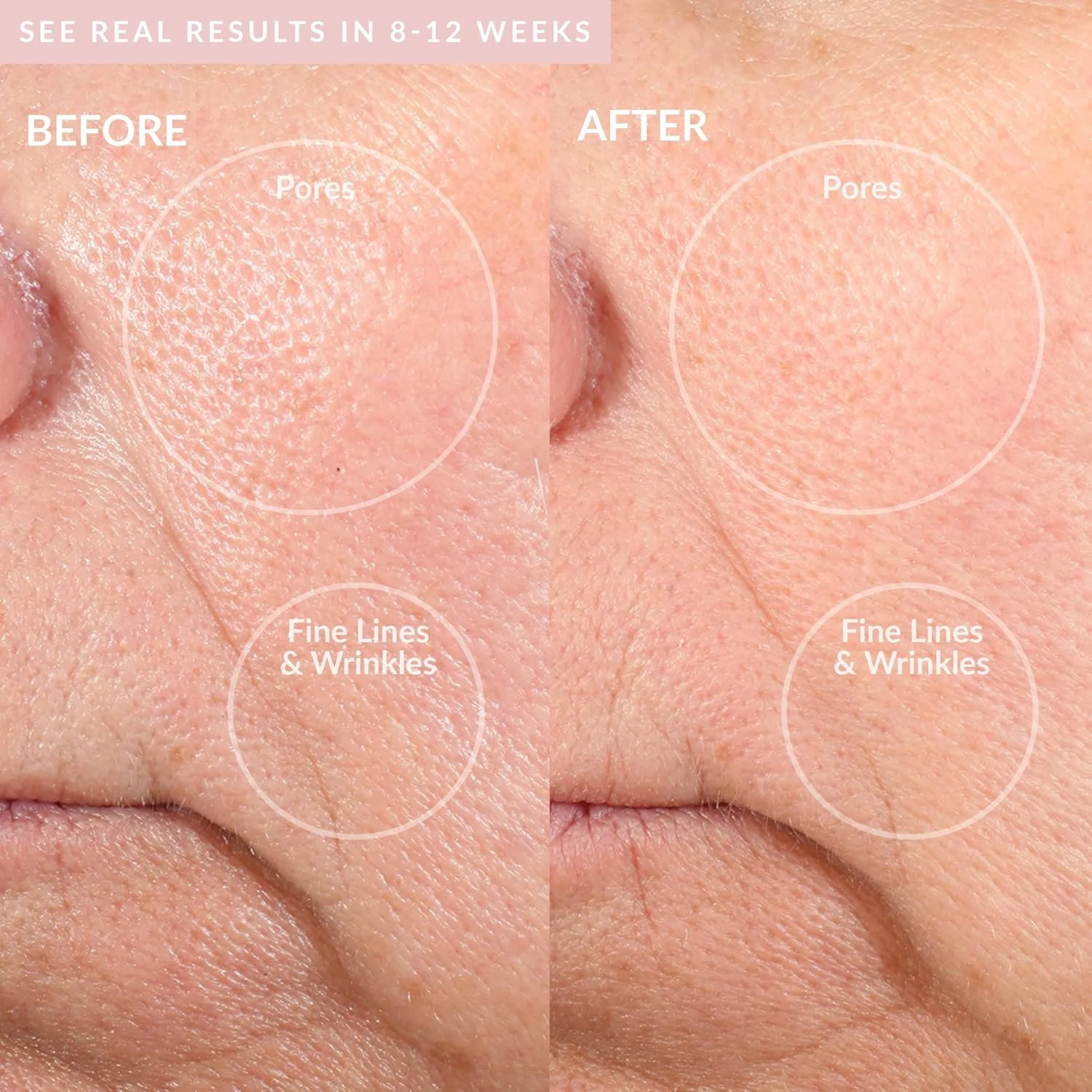 PMD Beauty Personal Microderm Pro - Инструмент для микродермабразии для домашнего использования, отшелушивающий скраб для лица и тела., Blush + Recovery Mask — фото 4