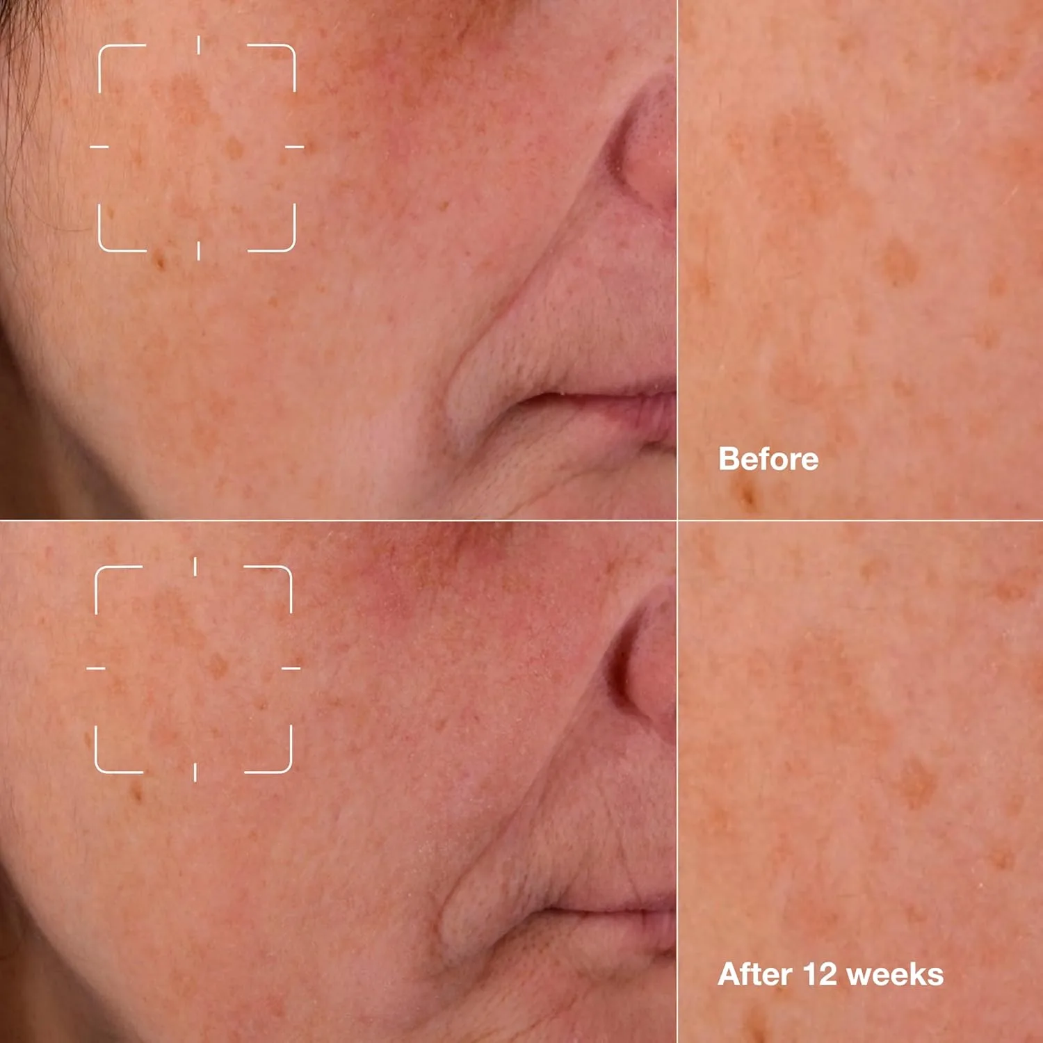 Сыворотка Clinique — Для лица Even Better Clinical для осветления пигментных пятен с витамином С для всех — фото 3