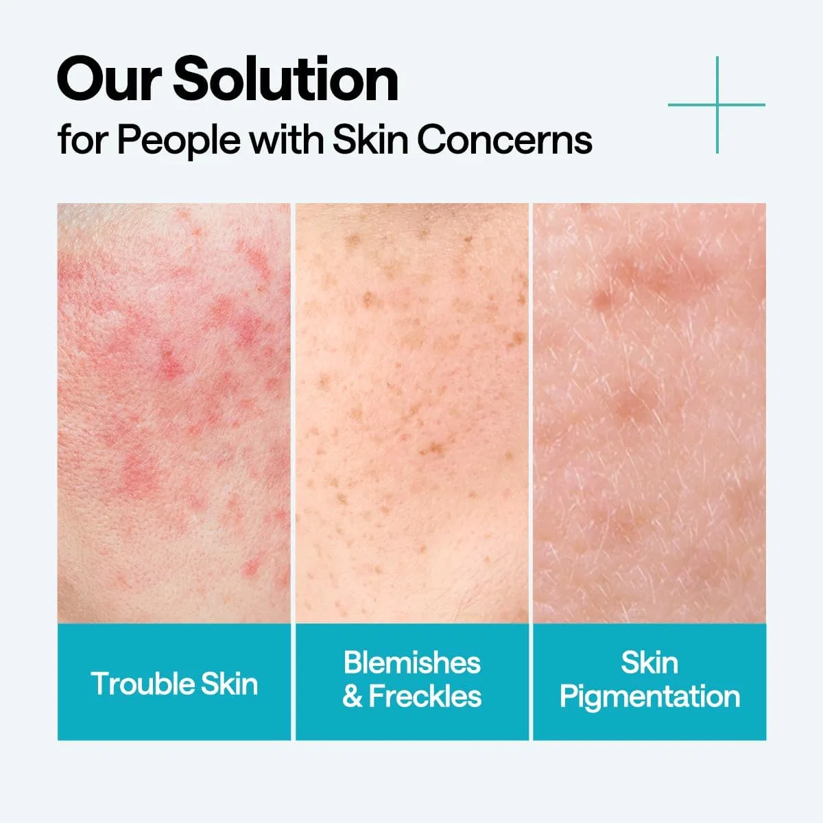 Сыворотка Mediheal — Против несовершенств Madecassoside Blemish Repair Serum, 40 мл — фото 4