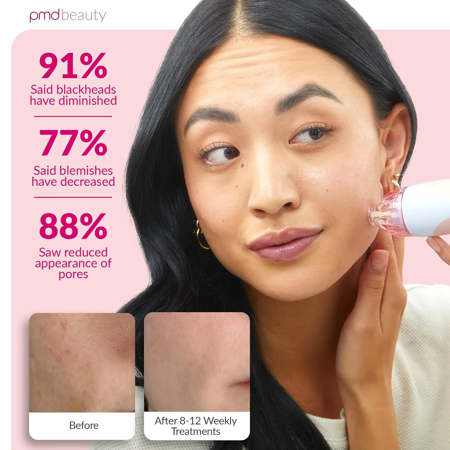 PMD Beauty Personal Microderm Classic - Набор для домашнего использования, инструмент для отшелушивания кожи лица, микродермабразия для ухода за кожей лица и тела., Blush, Recovery Mask — фото 4