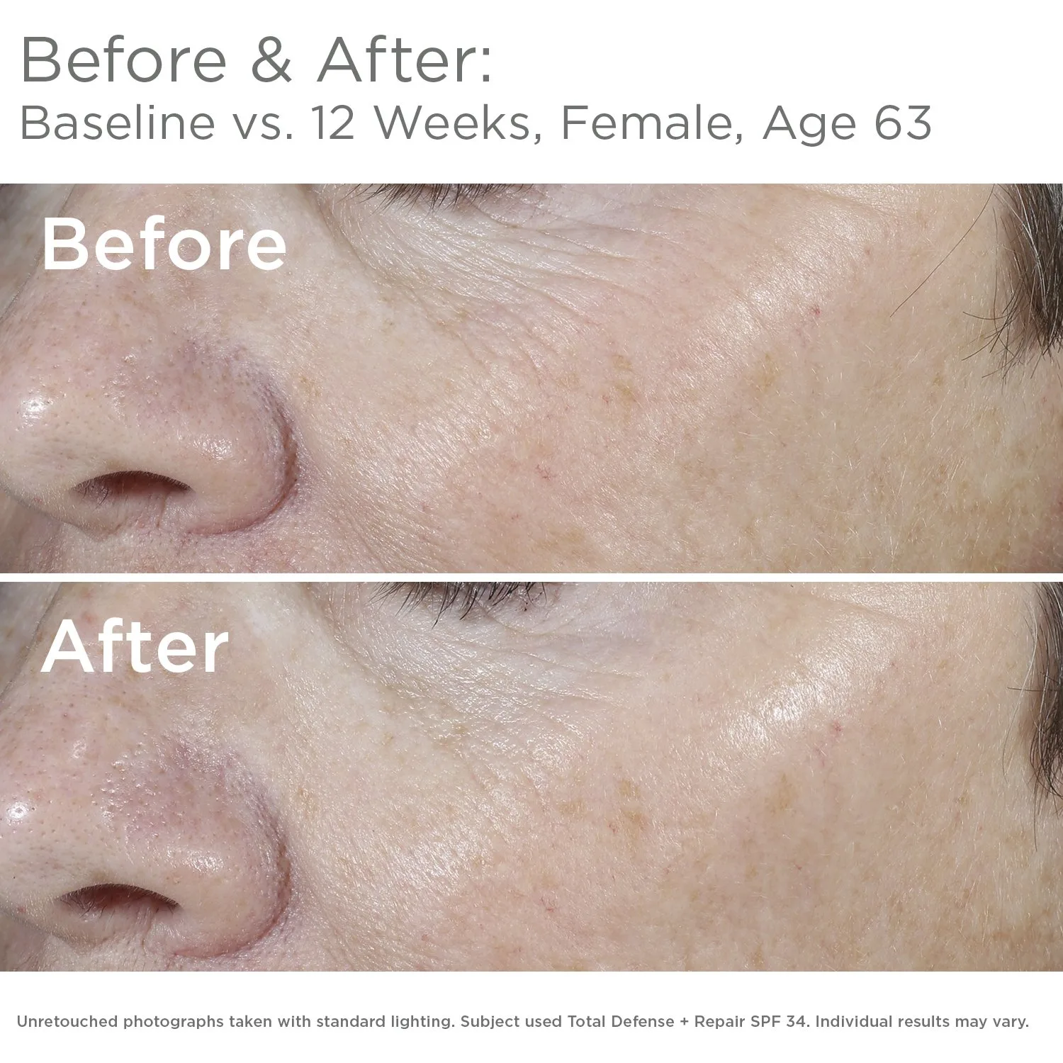 Солнцезащитный крем для лица SkinMedica Total Defense + Repair SPF 34 65.21 г (1 шт.), SPF 34 — фото 4