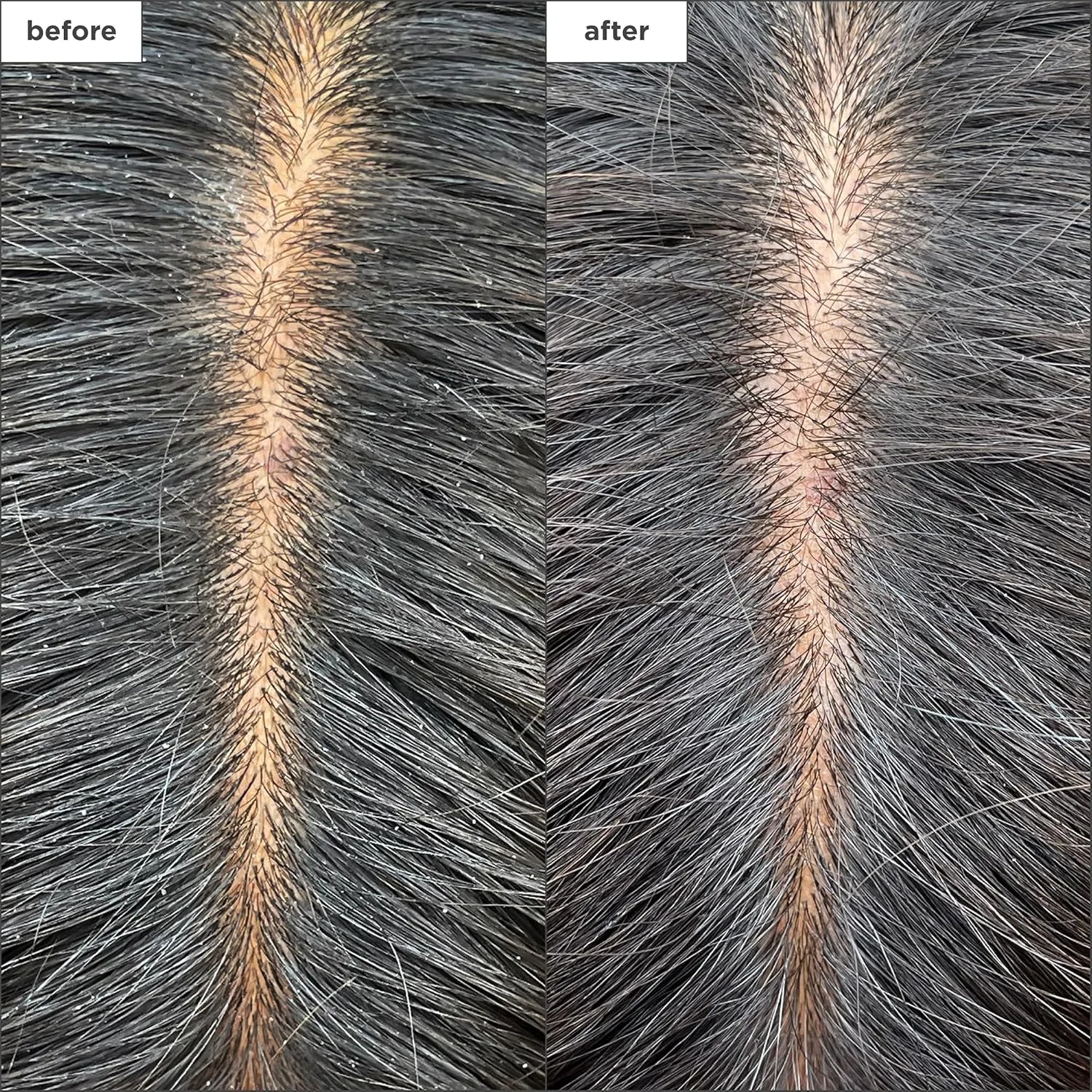 Briogeo Scalp Revival маска для увлажнения кожи головы с древесным углем и чайным деревом, 170 г 177 мл (1 шт.) — фото 3