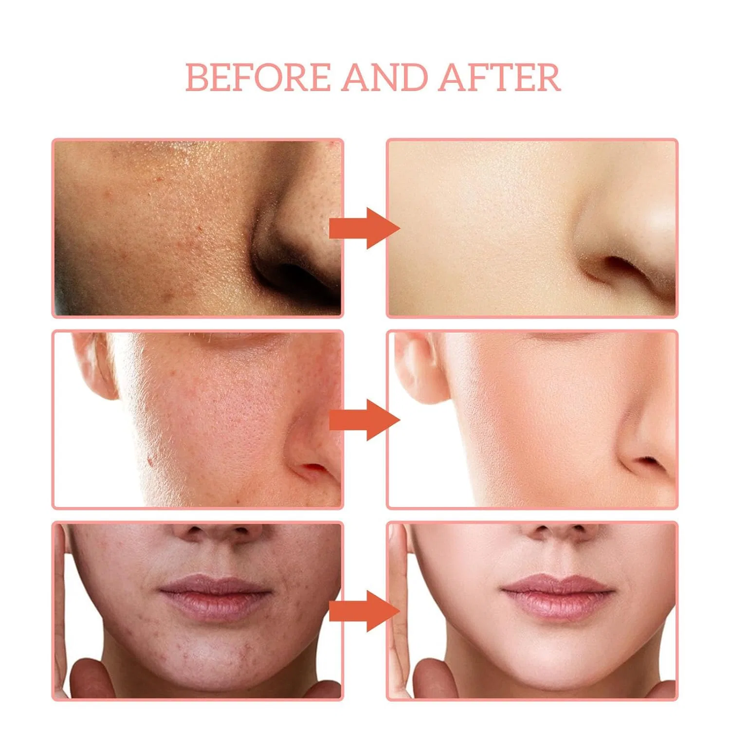 Эссенция ‎Jasubai — Для лица Finones Skin Vitamin -в-1 с витамином C и гиалуроновой кислотой ( .) Jasubai, 30 мл — фото 3