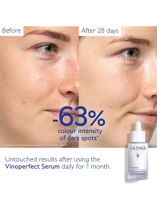 Сыворотка Caudalie — Осветляющая от пигментных пятен Vinoperfect с витамином С, 30 мл — фото 4