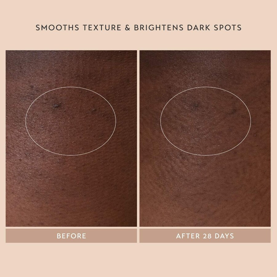 Сыворотка Shani Darden Skin Care — Для тела Body Reform Treatment Serum с % гранулятивным ретиноидом, 120 мл — фото 2