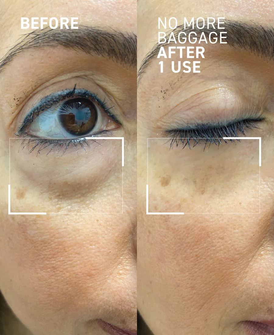 Крем для лица Dr. Brandt — Гель для снятия отечности под глазами No More Baggage Eye De-Puffing Gel, , None — фото 3