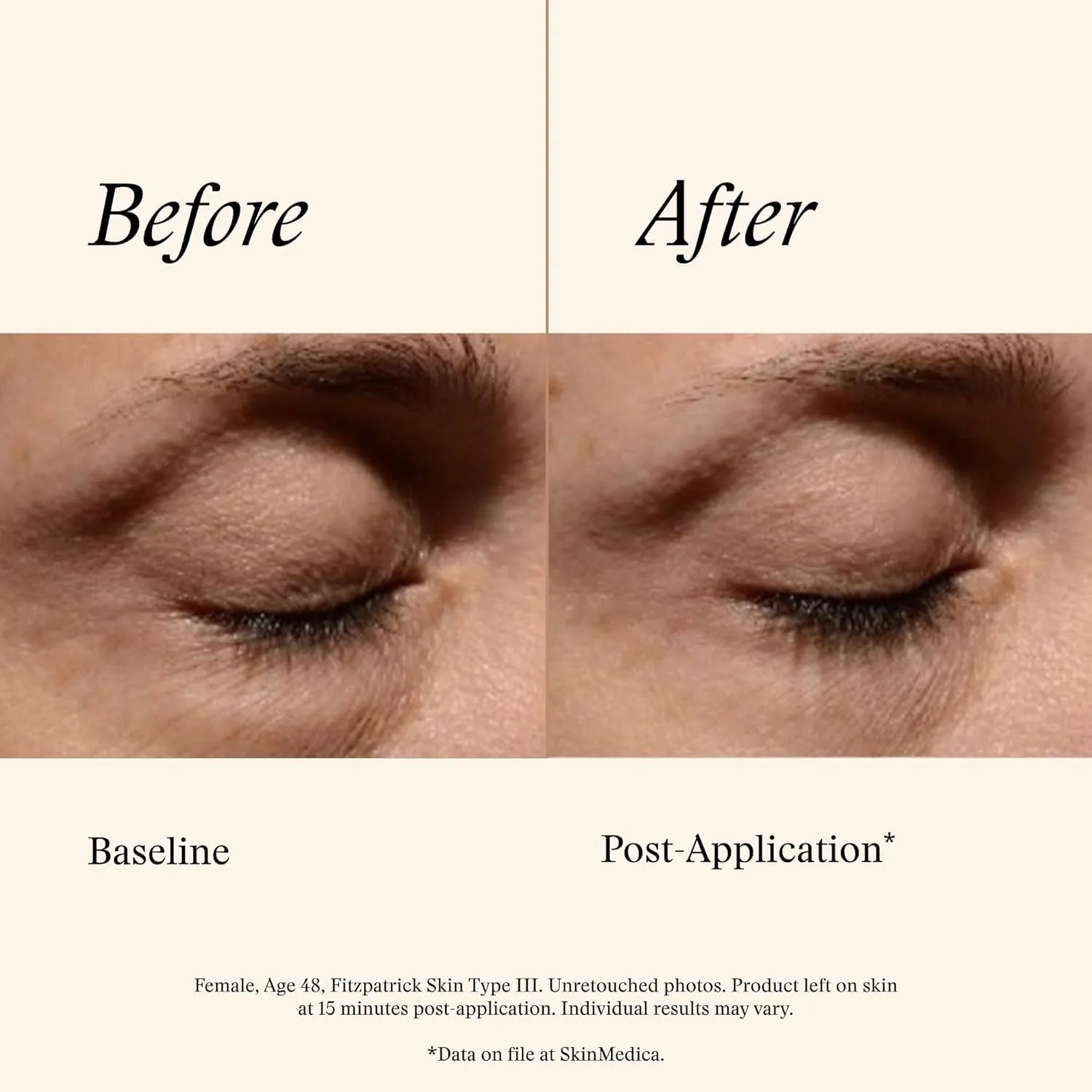 SkinMedica Instant Bright Eye Cream - антивозрастной крем для кожи вокруг глаз, мгновенно улучшающий внешний вид, включая темные круги, отечность и морщины 14,8 мл (1 шт.) — фото 4