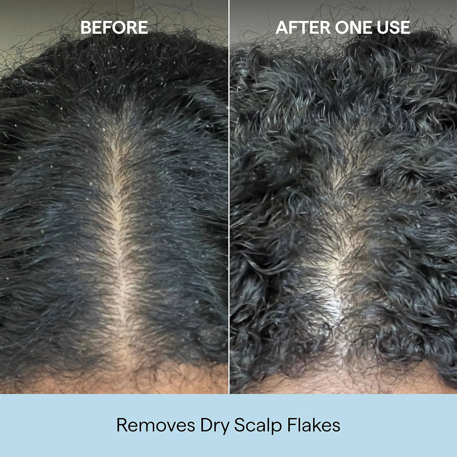 Микроотшелушивающий шампунь Scalp Revival Charcoal + Coconut Oil от Briogeo — фото 4