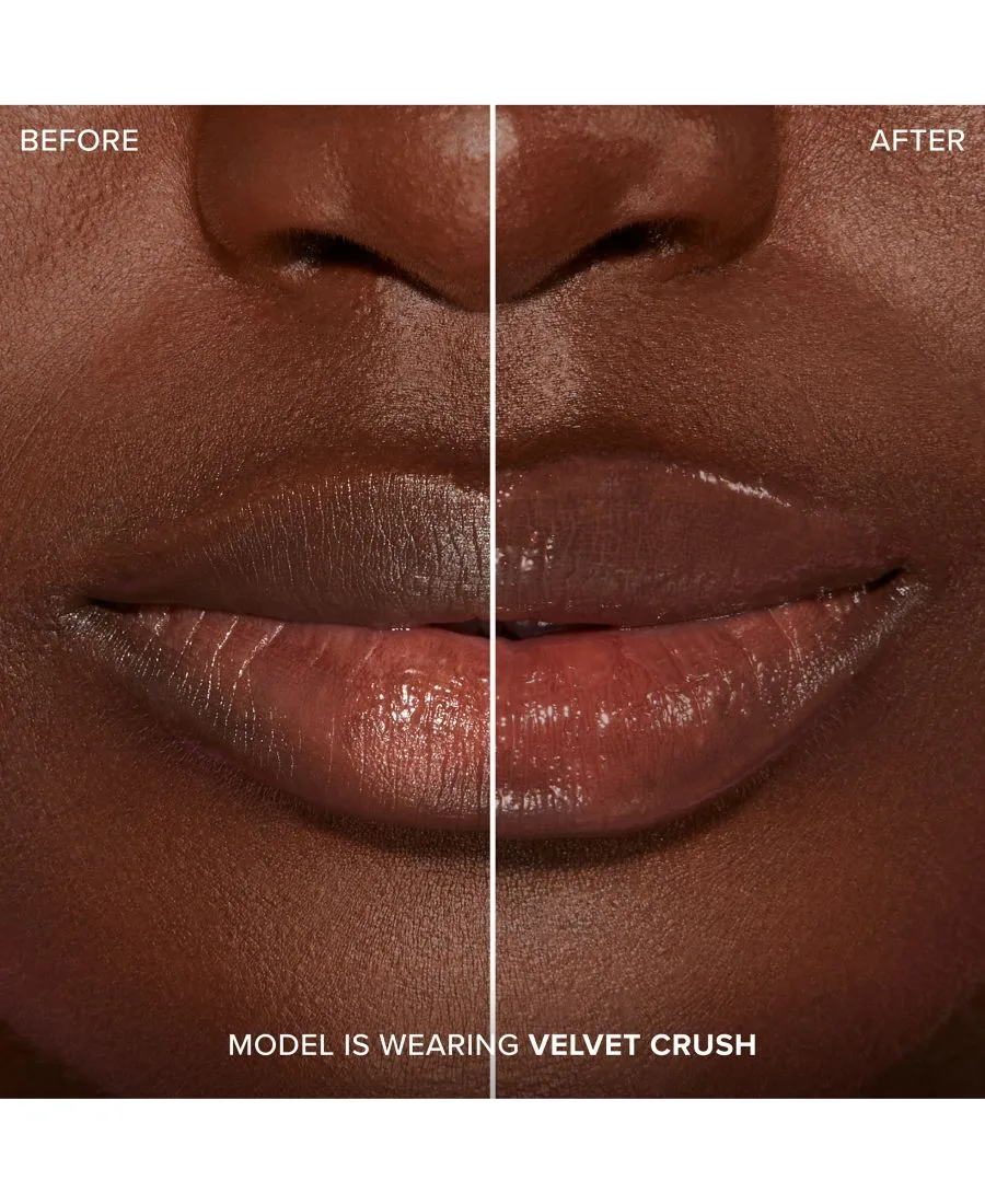 Увеличение губ с помощью инъекций для экстремального эффекта Clicks Too Faced, Velvet Crush — фото 2