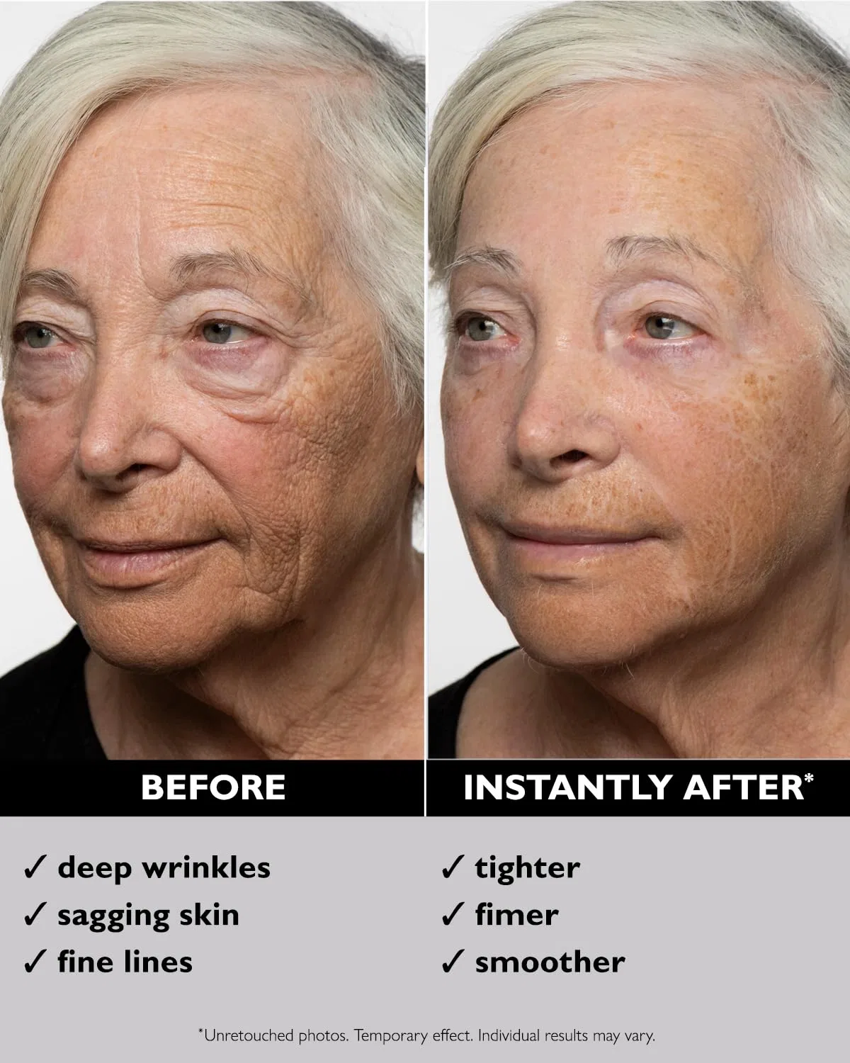 Гель для лица подтягивающий «Instant FIRMx Temporary Face Tightener» от Peter Thomas Roth Peter Thomas Roth — фото 2